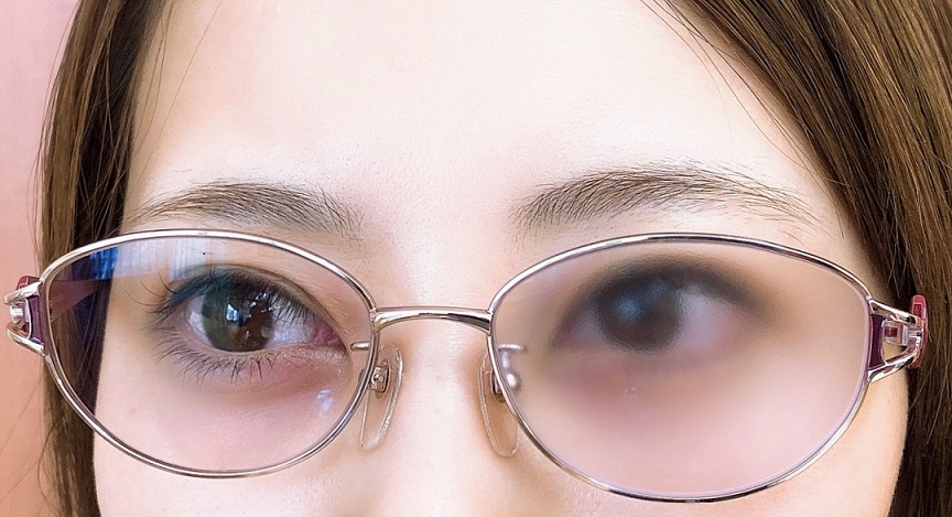 遮蔽レンズという選択（オクルア）【事例】｜ブログ｜メガネのヒルマ（群馬県桐生市）メガネ・補聴器・サングラス